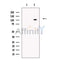 SLFN11 Antibody -DF13515