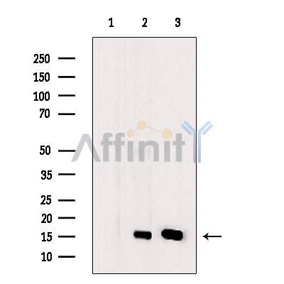 PFD6 Antibody -DF13522