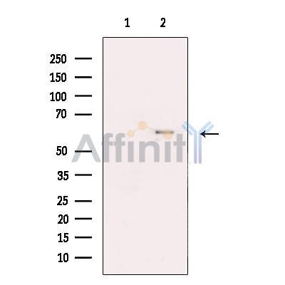 Kv1.6 Antibody -DF13523