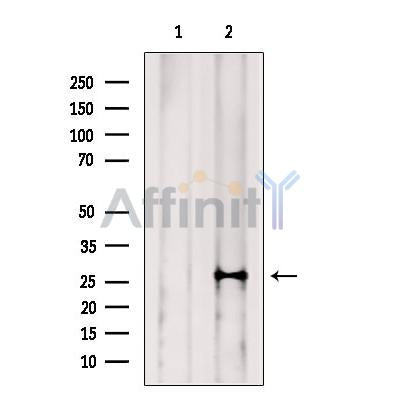 NAT14 Antibody -DF13526