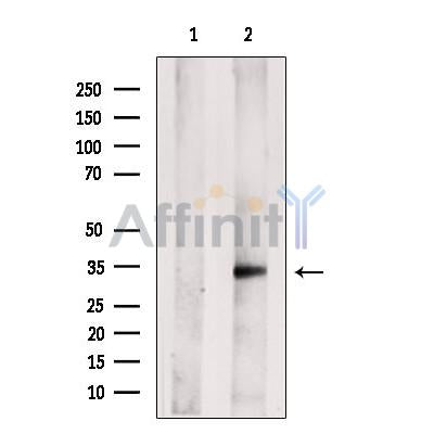 CLEC1 Antibody -DF13528
