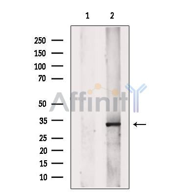 SET Antibody -DF13529