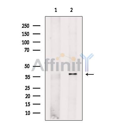 ACTR1A Antibody -DF13535