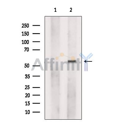 Ferredoxin Reductase Antibody -DF13537