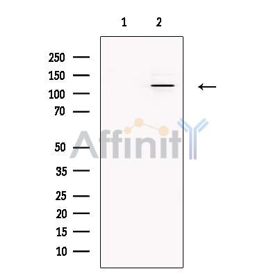SMARCA1 Antibody -DF13543