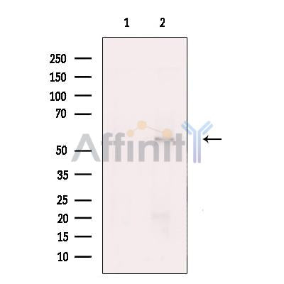 RBCK1 Antibody -DF13544