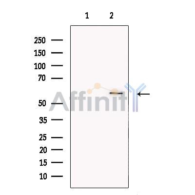 Glucose Transporter 5 GLUT5 Antibody -DF13545