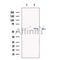 Glucose Transporter 5 GLUT5 Antibody -DF13545