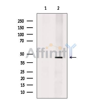 SERPINB1 Antibody -DF13548