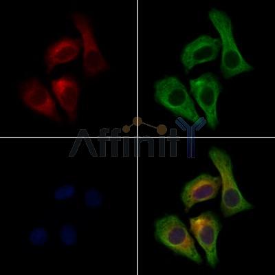 MAPRE1 Antibody -DF13549