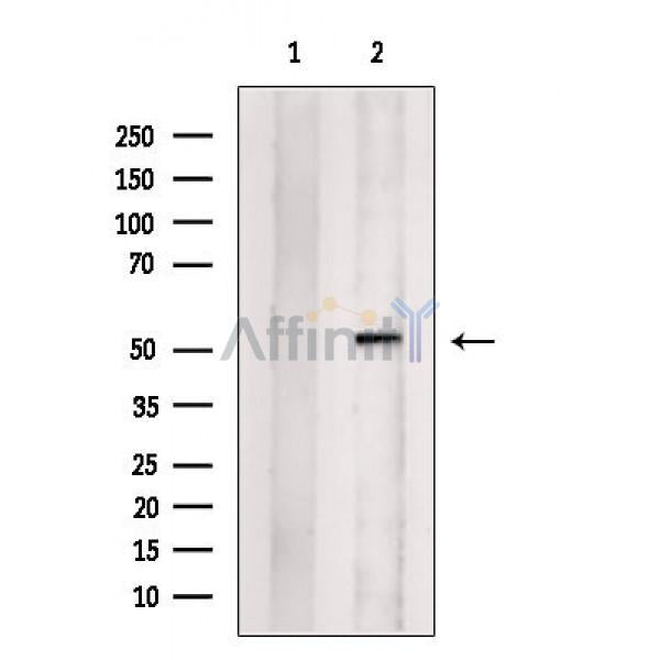 SNRP70 Antibody -DF13550