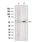 SNRP70 Antibody -DF13550