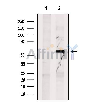 Ornithine Carbamoyltransferase Antibody -DF13552