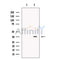 DARC Antibody -DF13554