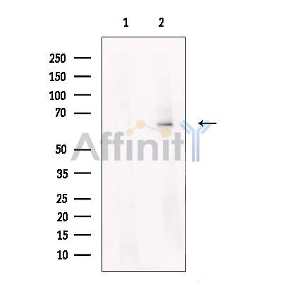 Steroid sulfatase Antibody -DF13557