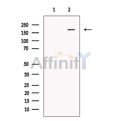 Synaptojanin Antibody -DF13566