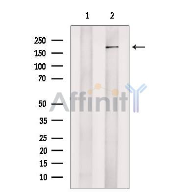 KDM4C / GASC1 / JMJD2C Antibody -DF13567