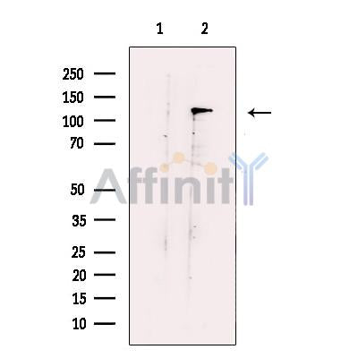 DAB2IP Antibody -DF13568