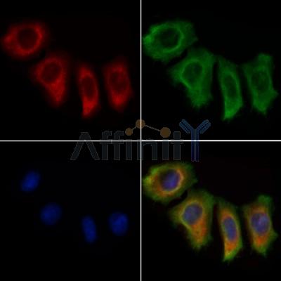 DBT Antibody -DF13569