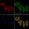DBT Antibody -DF13569