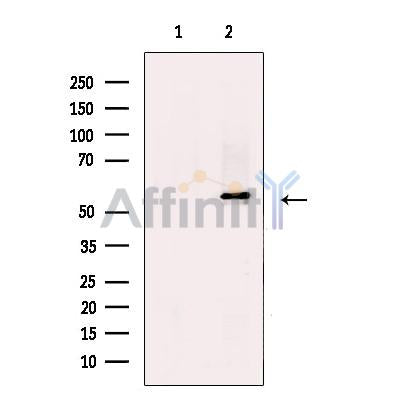 KMT5C/SUV4-20h2 Antibody -DF13570