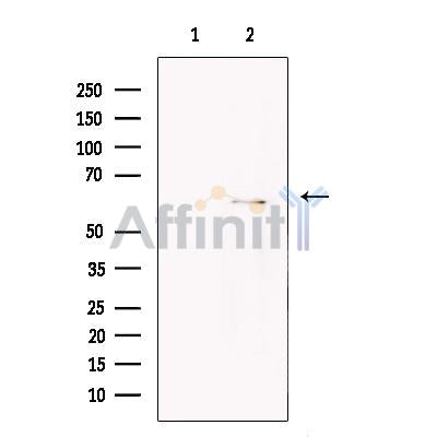 UGT1A6 Antibody -DF13573