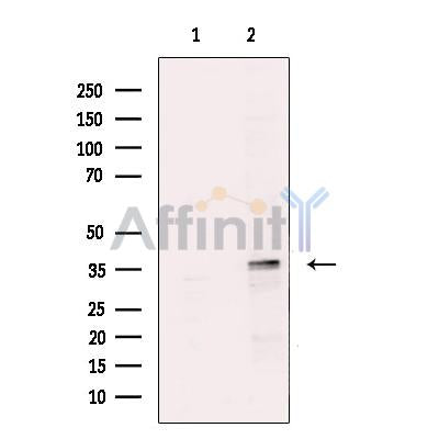 PITX2 Antibody -DF13574