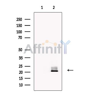 VPS29 Antibody -DF13575