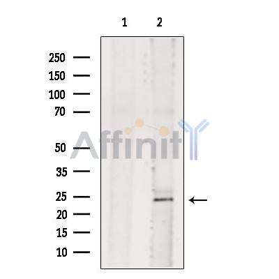 BASP1 Antibody -DF13578