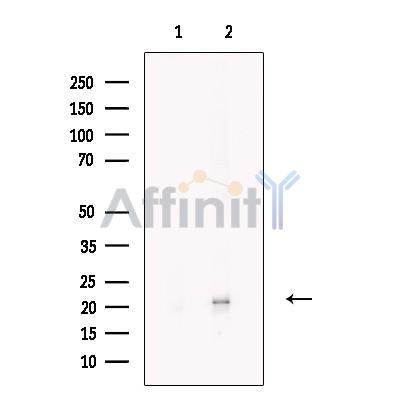 C9orf142 Antibody -DF13585