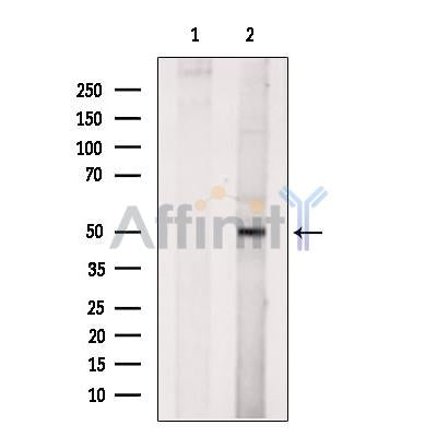 beta II Tubulin Antibody -DF13588