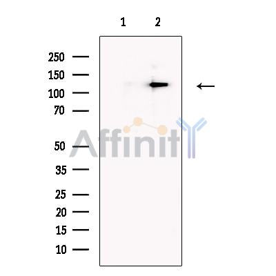 PTCH2 Antibody -DF13589