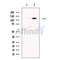 PTCH2 Antibody -DF13589