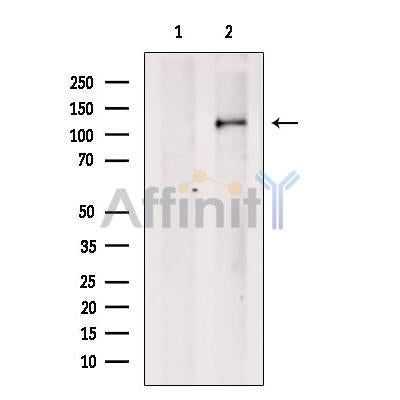 Anillin Antibody -DF13590