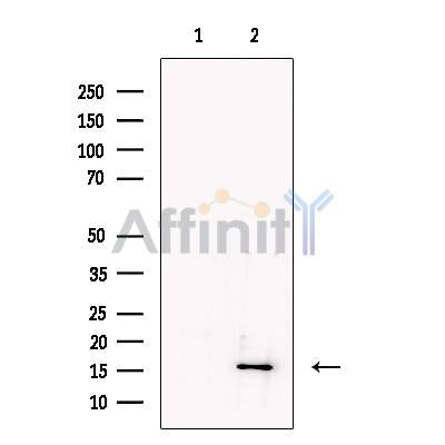 Hemoglobin subunit beta Antibody -DF13595