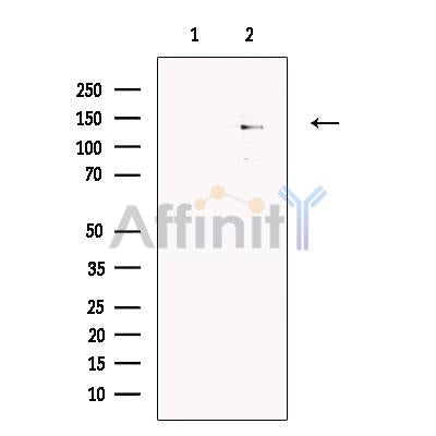 ABCB5 Antibody -DF13599