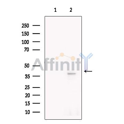 Surfactant protein D Antibody -DF13601