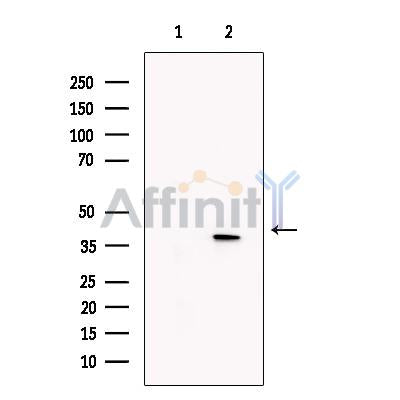 KLF2 Antibody -DF13602