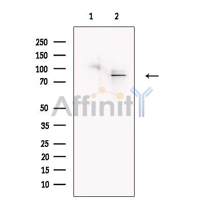 SLCO1C1 Antibody -DF13604