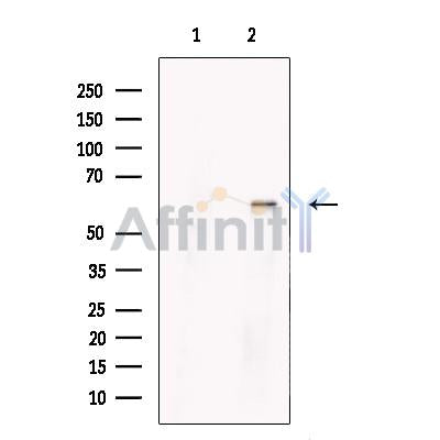 PRMT3 Antibody -DF13606