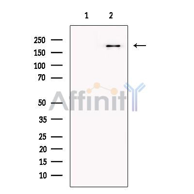 PRDM2 Antibody -DF13607