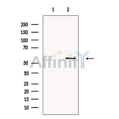 Melanopsin Antibody -DF13615