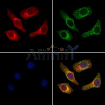 Gastrin Releasing Peptide Antibody -DF13618