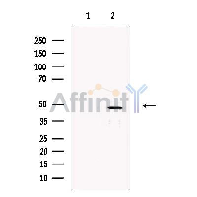 FOXF2 Antibody -DF13619