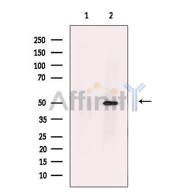 GABA A receptor pi Antibody -DF13621