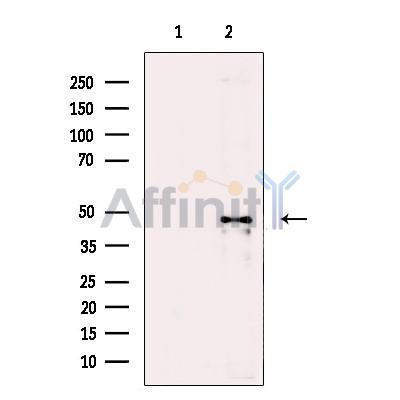 Dcp2 Antibody -DF13625