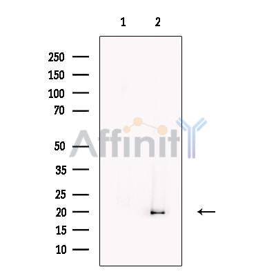 AIMP3/p18 Antibody -DF13629