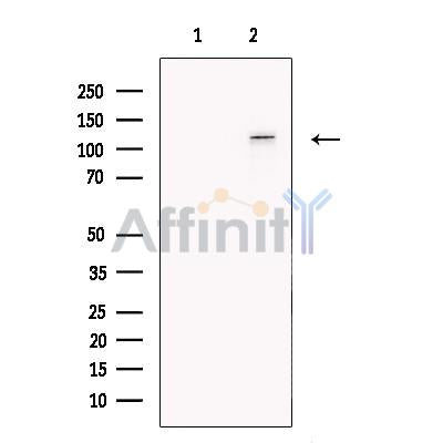 E1 Ubiquitin Activating Enzyme Antibody -DF13630
