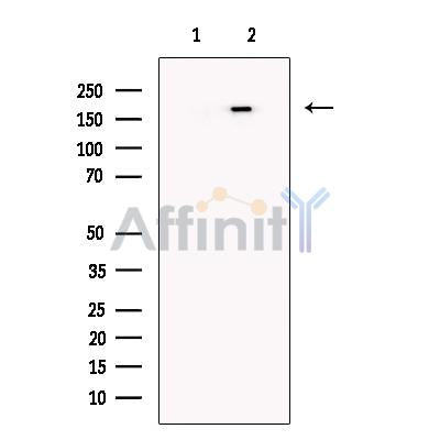 KDM5C / Jarid1C / SMCX Antibody -DF13631