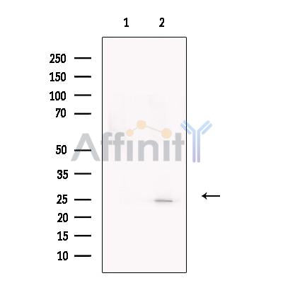 CTRP3 Antibody -DF13632
